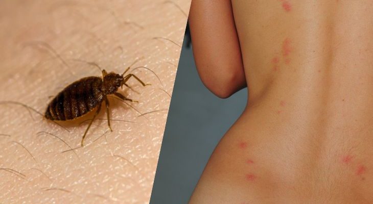 Как кусаются клопы и что важно знать жителям Израиля